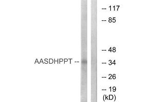 Western blot analysis of extracts from COLO cells, using AASDHPPT antibody. (AASDHPPT Antikörper  (N-Term))
