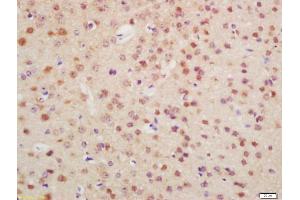 Formalin-fixed and paraffin embedded mouse brain labeled with Anti-OTX1 + OTX2 Polyclonal Antibody, Unconjugated (ABIN1387702) at 1:200 followed by conjugation to the secondary antibody and DAB staining (Otx1 + Otx2 (AA 21-120) Antikörper)