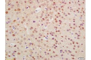 Formalin-fixed and paraffin embedded mouse brain labeled with Anti-OTX1 + OTX2 Polyclonal Antibody, Unconjugated (ABIN1387702) at 1:200 followed by conjugation to the secondary antibody and DAB staining (Otx1 + Otx2 (AA 21-120) Antikörper)