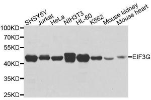 Western blot analysis of extracts of various cell lines, using EIF3G antibody. (EIF3G Antikörper  (AA 1-320))