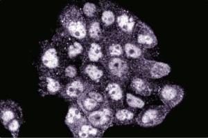 Immunofluorescence staining of A431 cells (Human epithelial carcinoma, ATCC CRL-1555). (BID Antikörper  (AA 50-62))