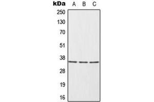 Western blot analysis of HUR expression in HeLa (A), Ramos (B), Jurkat (C) whole cell lysates.