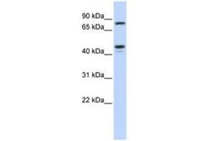 Image no. 1 for anti-Carbohydrate (N-Acetylglucosamine 6-O) Sulfotransferase 6 (CHST6) (AA 288-337) antibody (ABIN6743497) (CHST6 Antikörper  (AA 288-337))