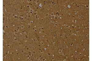 ABIN6274016 at 1/100 staining Rat brain tissue by IHC-P.
