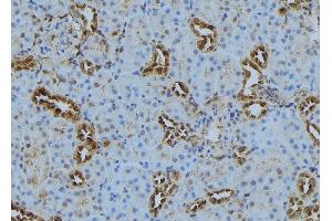 ABIN6272878 at 1/100 staining Mouse kidney tissue by IHC-P. (PLOD3 Antikörper  (C-Term))