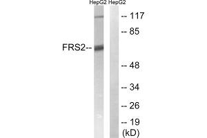 Western blot analysis of extracts from HepG2 cells, using FRS2 (epitope around residue 196) antibody. (FRS2 Antikörper  (Tyr196))