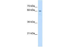 WB Suggested Anti-UNCX Antibody Titration:  1 ug/ml  Positive Control:  Jurkat cell lysate