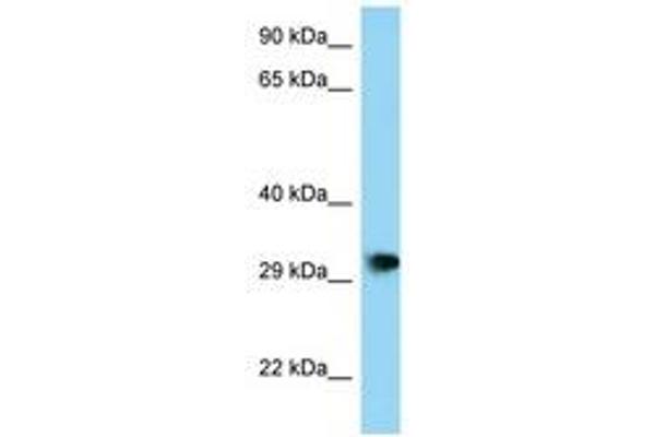 PHF23 抗体  (AA 191-240)