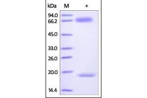 SDS-PAGE (SDS) image for Proprotein Convertase Subtilisin/kexin Type 9 (PCSK9) (AA 31-692) (Active) protein (His tag,AVI tag,Biotin) (ABIN2444171)