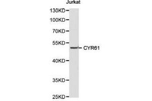 Western Blotting (WB) image for anti-Cysteine-Rich, Angiogenic Inducer, 61 (CYR61) antibody (ABIN1872182) (CYR61 Antikörper)