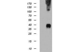 Image no. 1 for anti-Mitogen-Activated Protein Kinase Kinase 3 (MAP2K3) antibody (ABIN1499412) (MAP2K3 Antikörper)