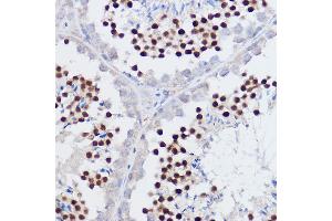 Immunohistochemistry of paraffin-embedded mouse testis using PPARD Rabbit pAb (ABIN6132423, ABIN6146002, ABIN6146003 and ABIN6221300) at dilution of 1:50 (40x lens). (PPARD Antikörper  (AA 102-361))
