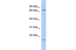 WB Suggested Anti-FUBP3 Antibody Titration: 0. (FUBP3 Antikörper  (N-Term))