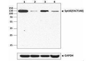 Western Blotting (WB) image for anti-FACT complex subunit SPT16 (SUPT16H) antibody (ABIN2666085) (SUPT16H Antikörper)