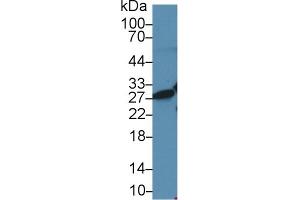 Western Blot; Sample: Human Jurkat cell lysate; Primary Ab: 2µg/ml Rabbit Anti-Rat HMG1 Antibody Second Ab: 0. (HMGB1 Antikörper  (AA 1-215))