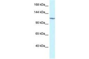 Image no. 1 for anti-Protein Kinase N2 (PKN2) (AA 605-654) antibody (ABIN6747330) (PKN2 Antikörper  (AA 605-654))