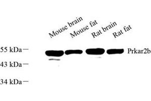 Western blot analysis of Prkar2b (ABIN7075565) at dilution of 1: 500