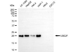 Western blotting analysis using UBE2F antibody (ABIN7800745).