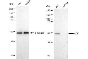 Western blotting analysis using ADK antibody (ABIN7797517). (Rekombinanter ADK Antikörper)