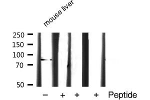 Western blot analysis of STAT3 expression in Mouse liver lysate (STAT3 Antikörper  (C-Term))