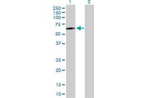 Western Blot analysis of CD4 expression in transfected 293T cell line by CD4 MaxPab polyclonal antibody. (CD4 Antikörper  (AA 1-458))