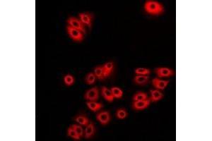Immunofluorescent analysis of Atlastin-1 staining in A549 cells. (ATL1 Antikörper)