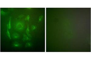 Immunofluorescence analysis of HepG2 cells, using Keratin 7 antibody (ABIN5976442). (Cytokeratin 7 Antikörper  (C-Term))