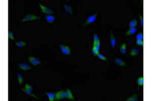 Immunofluorescent analysis of Hela cells using ABIN7152982 at dilution of 1:100 and Alexa Fluor 488-congugated AffiniPure Goat Anti-Rabbit IgG(H+L) (FAK Antikörper  (AA 363-464))