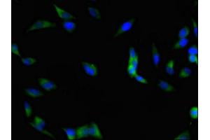 Immunofluorescence (IF) image for anti-PTK2 Protein tyrosine Kinase 2 (PTK2) (AA 363-464) antibody (ABIN7152982)