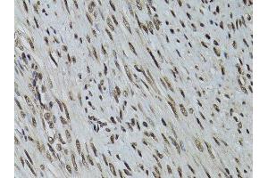 Immunohistochemistry (Paraffin-embedded Sections) (IHC (p)) image for anti-serine/threonine Kinase 11 (STK11) (AA 134-433) antibody (ABIN3022973)