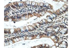 Immunohistochemical staining of formalin-fixed paraffin-embedded human fetal small intestine tissue showing cytoplasmic staining with NUDT7 polyclonal antibody  at 1 : 100 dilution.