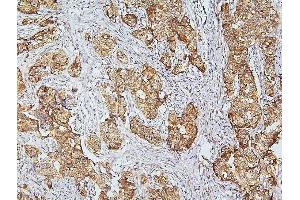 IHC analysis of CDK5 using anti-CDK5 antibody (ABIN6719393). (CDK5 Antikörper  (AA 1-226))
