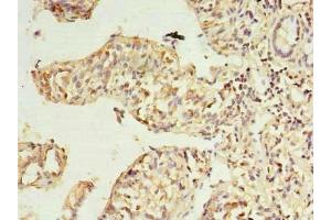 Immunohistochemistry of paraffin-embedded human small intestine tissue using ABIN7168501 at dilution of 1:100 (RWDD2A Antikörper  (AA 1-292))
