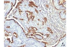 Immunohistochemistry (IHC) image for anti-Keratin 7 (KRT7) antibody (ABIN3025128)