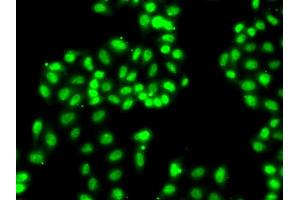 Immunofluorescence analysis of A549 cells using HNRNPA1 antibody. (HNRNPA1 Antikörper)
