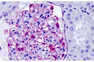 Anti-CLIC5 antibody IHC staining of human kidney, glomeruli. (CLIC5 Antikörper  (AA 91-191))