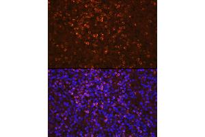 Immunofluorescence analysis of human spleen cells using Lipocalin-2/NGAL Rabbit pAb (ABIN3022890, ABIN3022891, ABIN3022892 and ABIN6219282) at dilution of 1:100 (40x lens). (Lipocalin 2 Antikörper  (AA 21-198))