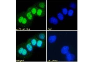 Immunofluorescence staining of fixed A431 with anti-p53 antibody (ABIN5668085) Immunofluorescence analysis of paraformaldehyde fixed A431 cells, permeabilized with 0. (Rekombinanter p53 Antikörper  (AA 371-380))