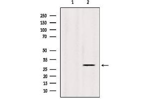 Western blot analysis of extracts from Sp2/0, using INSIG1 Antibody. (INSIG1 Antikörper  (Internal Region))