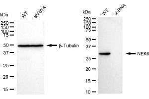 Western blotting analysis using NEK6 antibody (ABIN7799603).