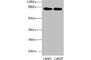 Western blot All lanes: LHCGR antibody at 2 μg/mL Lane 1: Mouse brain tissue Lane 2: Mouse kidney tissue Secondary Goat polyclonal to rabbit IgG at 1/10000 dilution Predicted band size: 79, 72 kDa Observed band size: 79 kDa (LHCGR Antikörper  (AA 27-363))
