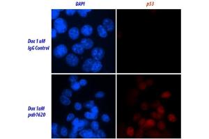 Image no. 2 for anti-Tumor Protein P53 (TP53) (Wild Type) antibody (ABIN2704419) (p53 Antikörper  (Wild Type))