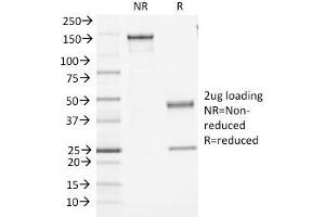 SDS-PAGE Analysis Purified CD45 Monoclonal Antibody (PTPRC/1461). (CD45 Antikörper)