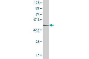 Western Blot detection against Immunogen (40. (HRSP12 Antikörper  (AA 1-137))