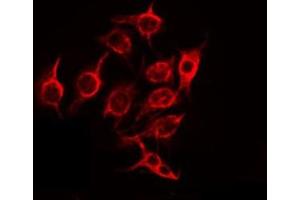 ABIN6275707 staining Hela by IF/ICC. (ZNHIT6 Antikörper  (Internal Region))
