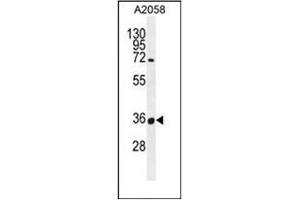 Western blot analysis of OR7G1 Antibody (N-term) in A2058 cell line lysates (35ug/lane). (OR7G1 Antikörper  (N-Term))