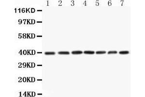 Western Blotting (WB) image for anti-Mitogen-Activated Protein Kinase Kinase 3 (MAP2K3) (AA 320-334), (C-Term) antibody (ABIN3044392)