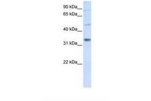 Image no. 1 for anti-Zinc Finger, CCHC Domain Containing 17 (ZCCHC17) (AA 146-195) antibody (ABIN6737801) (ZCCHC17 Antikörper  (AA 146-195))
