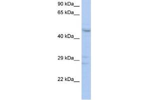 WB Suggested Anti-ACPL2 Antibody Titration:  0. (ACPL2 Antikörper  (Middle Region))