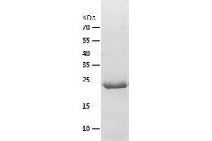 Western Blotting (WB) image for Adhesion Molecule, Interacts with CXADR Antigen 1 (AMICA1) (AA 6-235) protein (His tag) (ABIN7121723) (JAML Protein (AA 6-235) (His tag))